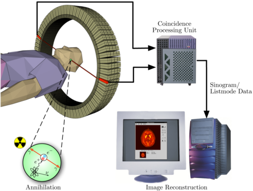 Positronen-Emissions-Tomographie Verfahren